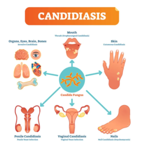 Anti kandida dijeta